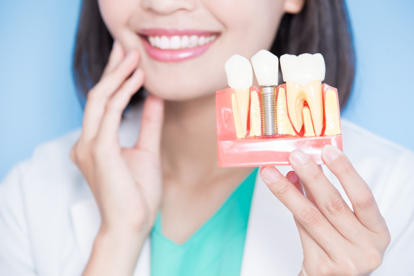 implantes dentales Alicante